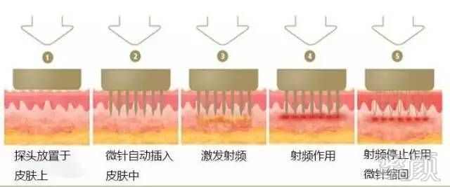 https://img.miyanlife.com/mnt/timg/171026/135501LB-8.jpg