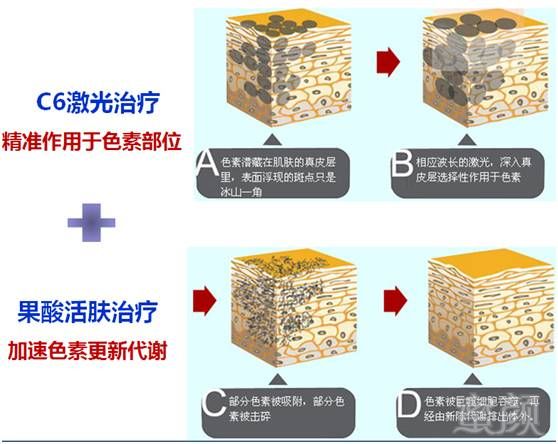 案例图片