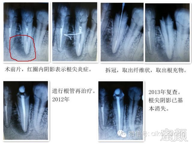 案例图片