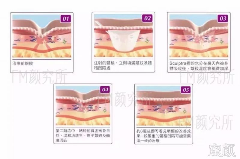 案例图片