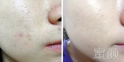 https://img.miyanlife.com/mnt/timg/171027/143P96301-6.jpg