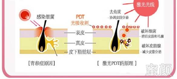 案例图片