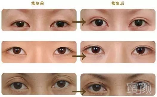 https://img.miyanlife.com/mnt/timg/171027/1541063440-1.jpg