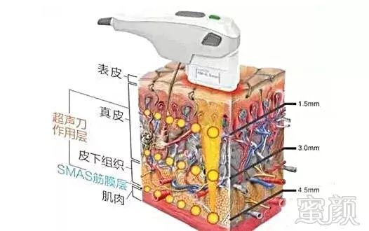 案例图片