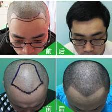 https://img.miyanlife.com/mnt/timg/171028/1115501L2-3.jpg