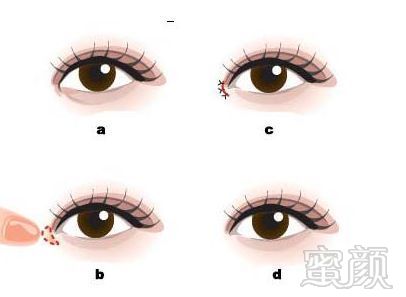 https://img.miyanlife.com/mnt/timg/171028/1131435115-0.jpg