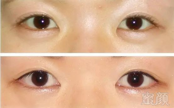 https://img.miyanlife.com/mnt/timg/171028/1131435621-2.jpg