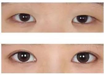 https://img.miyanlife.com/mnt/timg/171028/113143IR-6.jpg
