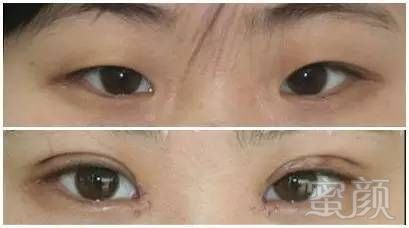 https://img.miyanlife.com/mnt/timg/171028/1131442419-14.jpg