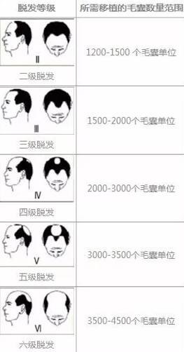 https://img.miyanlife.com/mnt/timg/171028/1141405Y9-0.jpg
