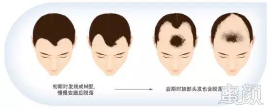 https://img.miyanlife.com/mnt/timg/171028/1144055Y7-2.jpg