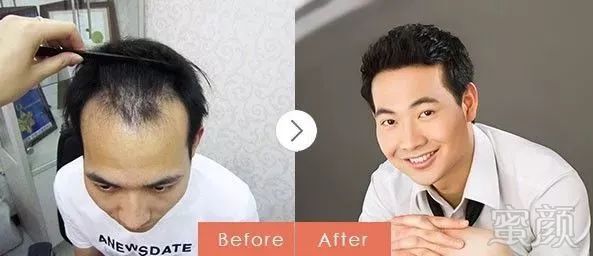 https://img.miyanlife.com/mnt/timg/171028/1144061527-6.jpg