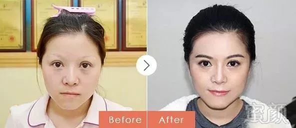 https://img.miyanlife.com/mnt/timg/171028/11440Cb2-5.jpg