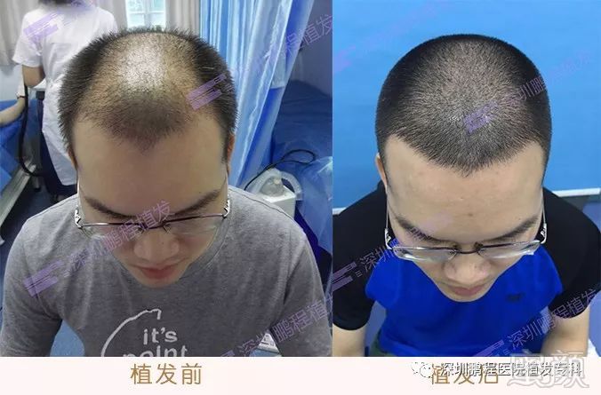 https://img.miyanlife.com/mnt/timg/171028/1144412S2-9.jpg