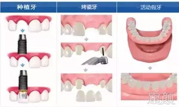 https://img.miyanlife.com/mnt/timg/171028/1351553923-5.jpg