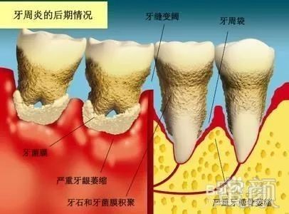 案例图片