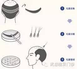 https://img.miyanlife.com/mnt/timg/171029/1334093239-2.jpg
