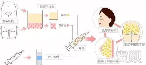 https://img.miyanlife.com/mnt/timg/171029/140333DO-2.jpg