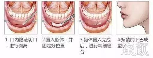 案例图片