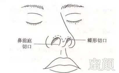 https://img.miyanlife.com/mnt/timg/171029/150J26496-9.jpg