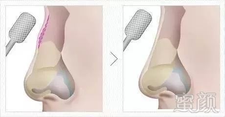 https://img.miyanlife.com/mnt/timg/171030/0931563b2-6.jpg