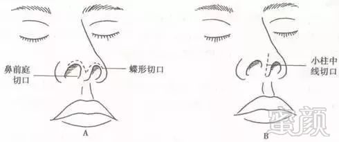 https://img.miyanlife.com/mnt/timg/171030/09325K413-4.jpg