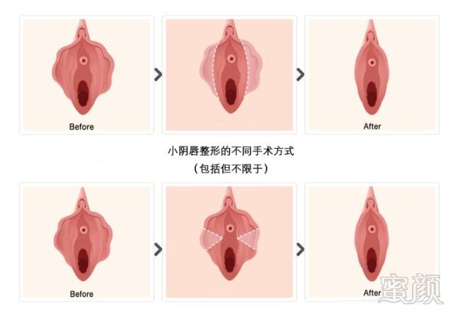 案例图片