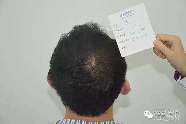 https://img.miyanlife.com/mnt/timg/171030/094P41T7-1.jpg