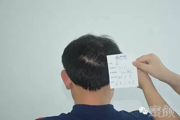 https://img.miyanlife.com/mnt/timg/171030/094PI2G-12.jpg