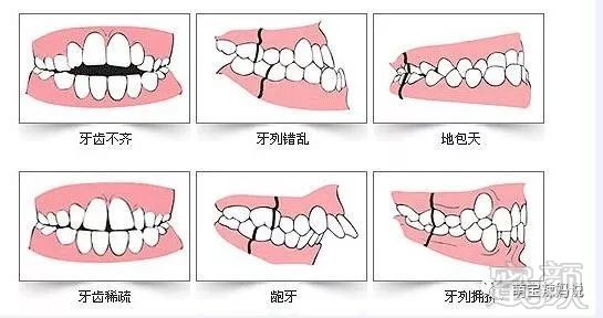 案例图片