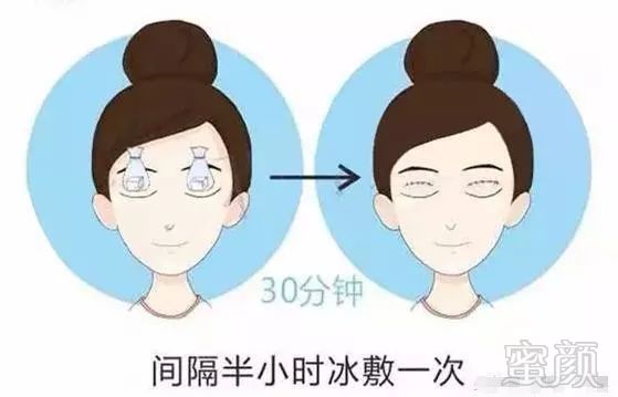 https://img.miyanlife.com/mnt/timg/171030/120PS017-2.jpg