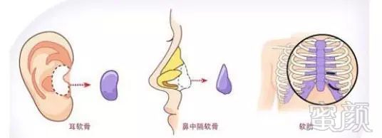 https://img.miyanlife.com/mnt/timg/171030/121IJP0-1.jpg