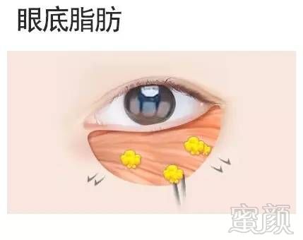 https://img.miyanlife.com/mnt/timg/171030/121IR064-6.jpg