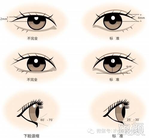 https://img.miyanlife.com/mnt/timg/171030/121IS335-7.jpg