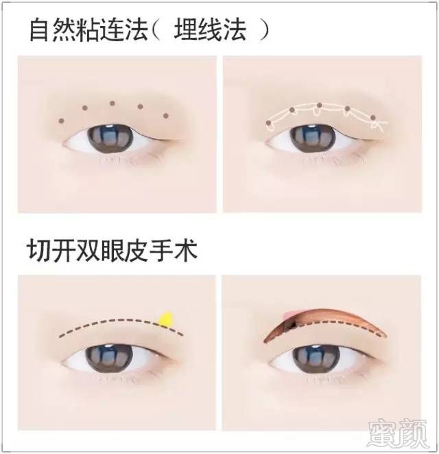 https://img.miyanlife.com/mnt/timg/171030/121ITQ6-4.jpg