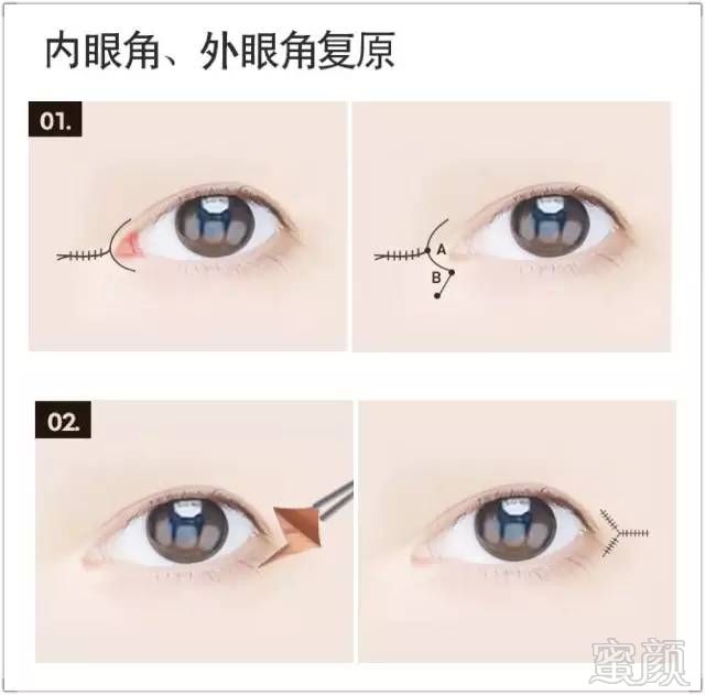 https://img.miyanlife.com/mnt/timg/171030/121IW339-5.jpg