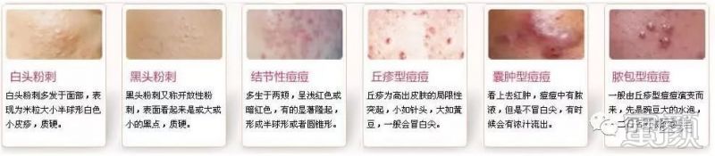 https://img.miyanlife.com/mnt/timg/171030/122R114S-4.jpg