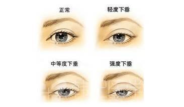 https://img.miyanlife.com/mnt/timg/171030/142A4H41-4.jpg