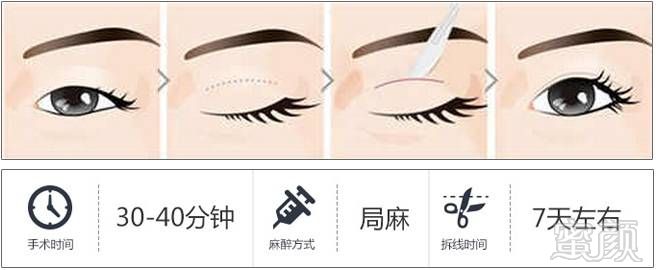 https://img.miyanlife.com/mnt/timg/171030/142A51250-7.jpg