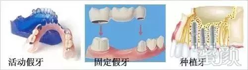 https://img.miyanlife.com/mnt/timg/171031/10355T635-2.jpg