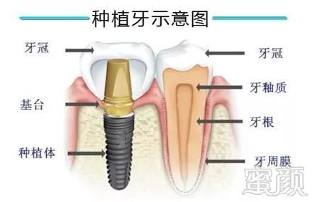 https://img.miyanlife.com/mnt/timg/171031/10355WH6-3.jpg
