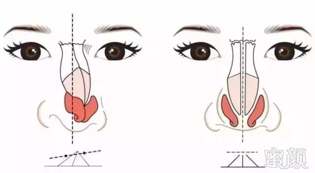 https://img.miyanlife.com/mnt/timg/171031/105JHb0-2.jpg
