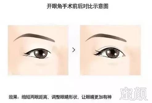https://img.miyanlife.com/mnt/timg/171031/1245561224-3.jpg