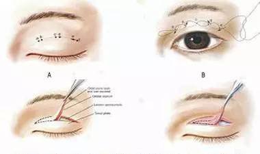 https://img.miyanlife.com/mnt/timg/171031/1245563161-6.jpg