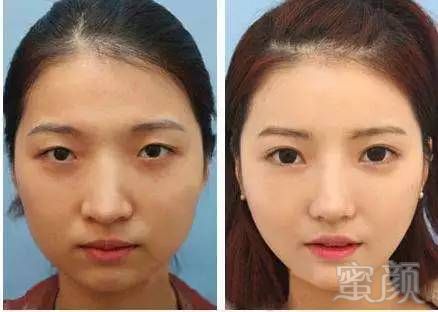 https://img.miyanlife.com/mnt/timg/171031/12455CM2-2.jpg