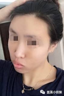https://img.miyanlife.com/mnt/timg/171031/1302055927-4.jpg