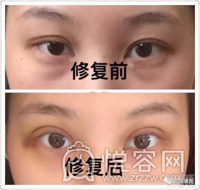 https://img.miyanlife.com/mnt/timg/171031/1415151496-0.jpg