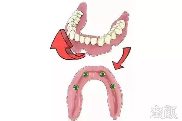 https://img.miyanlife.com/mnt/timg/171031/1421052402-14.jpg