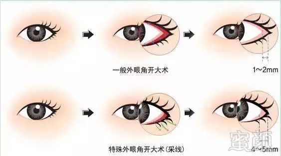 https://img.miyanlife.com/mnt/timg/171031/142459DB-5.jpg