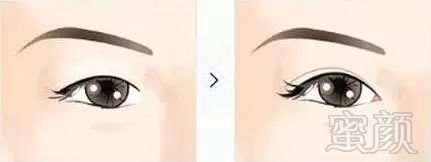 https://img.miyanlife.com/mnt/timg/171031/14245QE5-3.jpg
